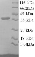Recombinant Human Reticulocalbin-1 (RCN1), partial – Figure 1 of 1