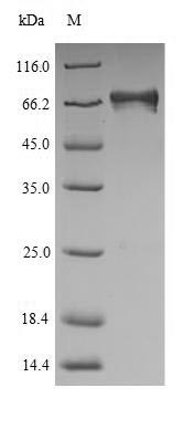 Recombinant Human Electron transfer flavoprotein-ubiquinone oxidoreductase, mitochondrial (ETFDH) – Figure 1 of 1
