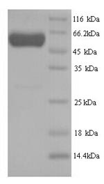 Recombinant Human Septin-7 (SEPT7) – Figure 1 of 1