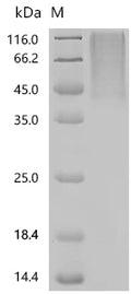 (Tris-Glycine gel) Discontinuous SDS-PAGE (reduced) with 5% enrichment gel and 15% separation gel.