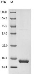 Recombinant Human Melanoma antigen recognized by T-cells 1 (MLANA) – Figure 1 of 1