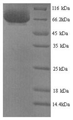 Recombinant Human Inactive tyrosine-protein kinase 7 (PTK7), partial – Figure 1 of 1