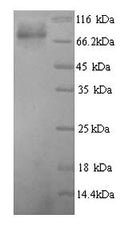 Recombinant Human Glucokinase regulatory protein (GCKR) – Figure 1 of 1