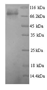 Recombinant Human Glucokinase regulatory protein (GCKR) – Figure 1 of 1