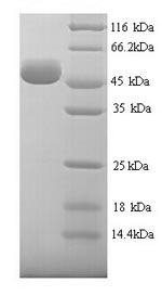 Recombinant Human Hyaluronidase-1 (HYAL1) – Figure 1 of 1