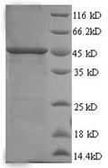 Recombinant Human SWI/SNF-related matrix-associated actin-dependent regulator of chromatin subfamily B member 1 (SMARCB1), pa