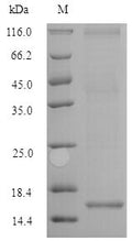 Recombinant Human/Cynomolgus monkey Activin receptor type-2B (ACVR2B), partial – Figure 1 of 1