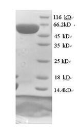 Recombinant Human Dihydropyrimidinase-related protein 1 (CRMP1) – Figure 1 of 1