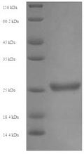 Recombinant Human Killer cell immunoglobulin-like receptor 2DS1 (KIR2DS1), partial – Figure 1 of 1