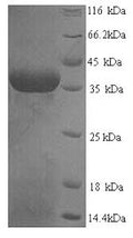 Recombinant Human Squamous cell carcinoma antigen recognized by T-cells 3 (SART3), partial – Figure 1 of 1