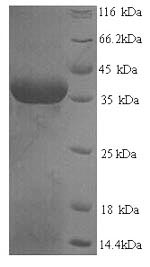 Recombinant Human Squamous cell carcinoma antigen recognized by T-cells 3 (SART3), partial – Figure 1 of 1