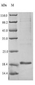 Recombinant Dog Epididymal secretory protein E1 (NPC) – Figure 1 of 1