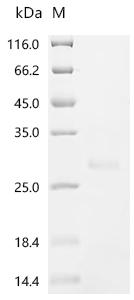 (Tris-Glycine gel) Discontinuous SDS-PAGE (reduced) with 5% enrichment gel and 15% separation gel.