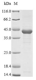 (Tris-Glycine gel) Discontinuous SDS-PAGE (reduced) with 5% enrichment gel and 15% separation gel.