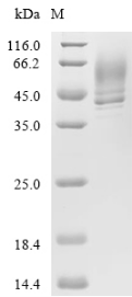 (Tris-Glycine gel) Discontinuous SDS-PAGE (reduced) with 5% enrichment gel and 15% separation gel.