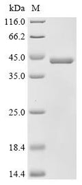 (Tris-Glycine gel) Discontinuous SDS-PAGE (reduced) with 5% enrichment gel and 15% separation gel.