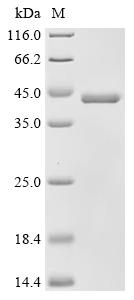 (Tris-Glycine gel) Discontinuous SDS-PAGE (reduced) with 5% enrichment gel and 15% separation gel.