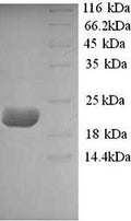Recombinant Sheep Interleukin-10 (IL10) – Figure 1 of 1