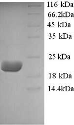 Recombinant Sheep Interleukin-10 (IL10) – Figure 1 of 1