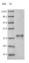 Recombinant Mouse Scavenger receptor cysteine-rich type 1 protein M130 (Cd163), partial – Figure 1 of 1