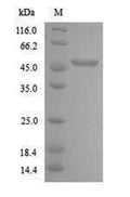 (Tris-Glycine gel) Discontinuous SDS-PAGE (reduced) with 5% enrichment gel and 15% separation gel.