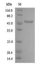 (Tris-Glycine gel) Discontinuous SDS-PAGE (reduced) with 5% enrichment gel and 15% separation gel.
