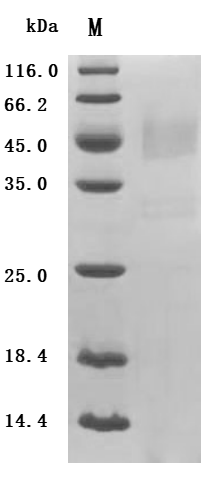 (Tris-Glycine gel) Discontinuous SDS-PAGE (reduced) with 5% enrichment gel and 15% separation gel.
