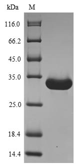 (Tris-Glycine gel) Discontinuous SDS-PAGE (reduced) with 5% enrichment gel and 15% separation gel.