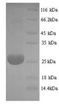 Recombinant Bovine Adiponectin (ADIPOQ) – Figure 1 of 1