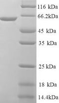 Recombinant Human Innate immunity activator protein (INAVA) – Figure 1 of 1