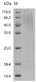 (Tris-Glycine gel) Discontinuous SDS-PAGE (reduced) with 5% enrichment gel and 15% separation gel.