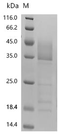 (Tris-Glycine gel) Discontinuous SDS-PAGE (reduced) with 5% enrichment gel and 15% separation gel.