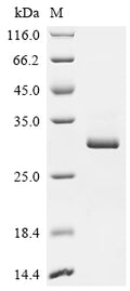 (Tris-Glycine gel) Discontinuous SDS-PAGE (reduced) with 5% enrichment gel and 15% separation gel.