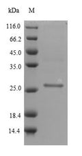 Recombinant Staphylococcus aureus Staphylococcal secretory antigen ssaA1 (ssaA1) – Figure 1 of 1