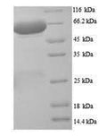 Recombinant Rat Putative phospholipase B-like 2 (Plbd2) – Figure 1 of 1