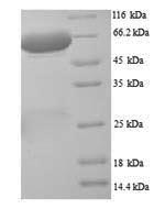 Recombinant Rat Putative phospholipase B-like 2 (Plbd2) – Figure 1 of 1