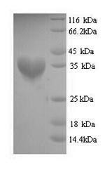Recombinant Staphylococcus aureus Malonyl CoA-acyl carrier protein transacylase (fabD) – Figure 1 of 1
