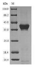 (Tris-Glycine gel) Discontinuous SDS-PAGE (reduced) with 5% enrichment gel and 15% separation gel.