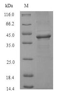 (Tris-Glycine gel) Discontinuous SDS-PAGE (reduced) with 5% enrichment gel and 15% separation gel.