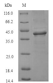 (Tris-Glycine gel) Discontinuous SDS-PAGE (reduced) with 5% enrichment gel and 15% separation gel.