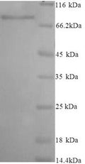 Recombinant Human Inactive N-acetylated-alpha-linked acidic dipeptidase-like protein 2 (NAALADL2), partial – Figure 1 of 1