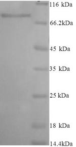 Recombinant Human Inactive N-acetylated-alpha-linked acidic dipeptidase-like protein 2 (NAALADL2), partial – Figure 1 of 1