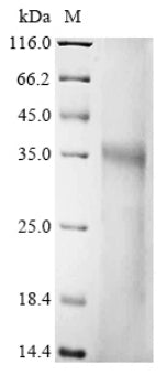(Tris-Glycine gel) Discontinuous SDS-PAGE (reduced) with 5% enrichment gel and 15% separation gel.