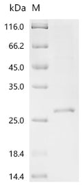 (Tris-Glycine gel) Discontinuous SDS-PAGE (reduced) with 5% enrichment gel and 15% separation gel.