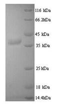 Recombinant Mouse Tyrosine-protein kinase JAK3 (Jak3), partial – Figure 1 of 1
