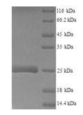 Recombinant Mouse Lymphocyte antigen 6E (Ly6e) – Figure 1 of 1