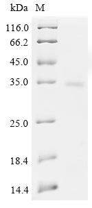 (Tris-Glycine gel) Discontinuous SDS-PAGE (reduced) with 5% enrichment gel and 15% separation gel.