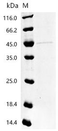 (Tris-Glycine gel) Discontinuous SDS-PAGE (reduced) with 5% enrichment gel and 15% separation gel.