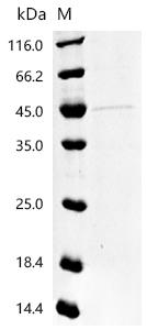 (Tris-Glycine gel) Discontinuous SDS-PAGE (reduced) with 5% enrichment gel and 15% separation gel.