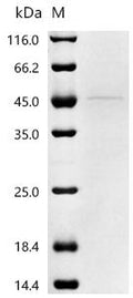 (Tris-Glycine gel) Discontinuous SDS-PAGE (reduced) with 5% enrichment gel and 15% separation gel.
